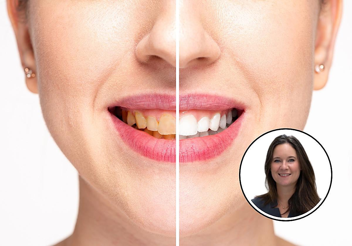 El aviso de una dentista: «Las causas de los dientes amarillos van más allá de la higiene»