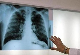 Reclaman 230.000 euros por la muerte de un trabajador vasco expuesto al amianto