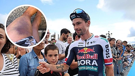 Un atropello deja a Roglic fuera de la Clásica de San Sebastián
