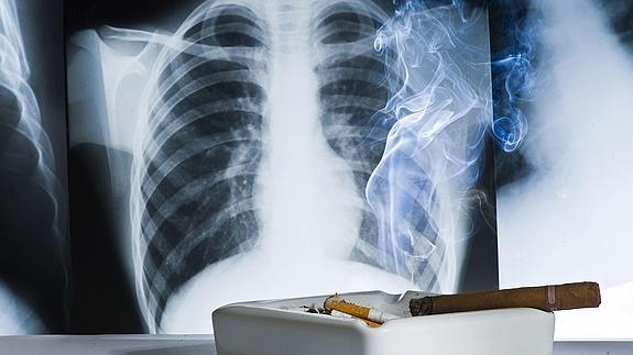 Un cenicero, junto a una radiografía de un pulmón.