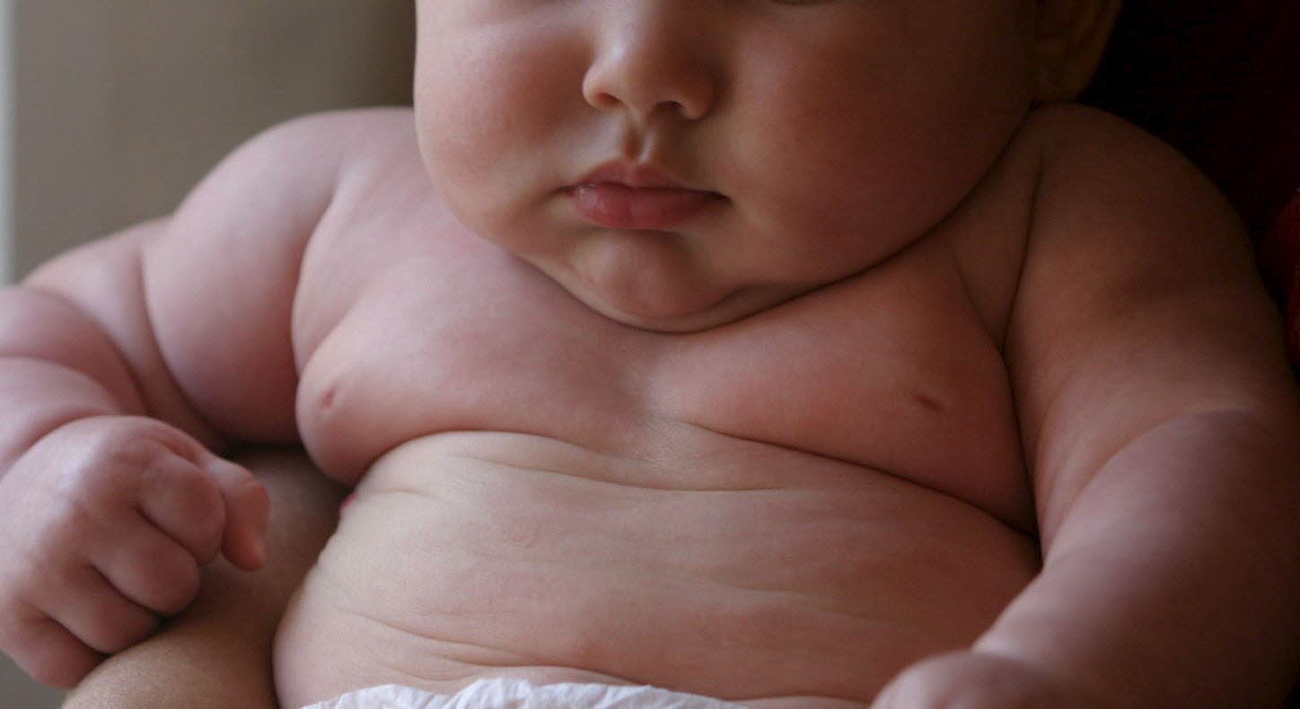 España es el segundo país europeo con mayor tasa de obesidad infantil.