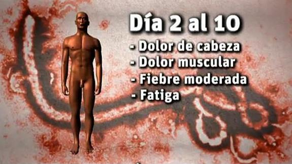 Así lucha el cuerpo humano contra el ébola