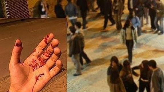 «Nos llamaron mariquitas, nos dieron una paliza y nadie hizo nada»