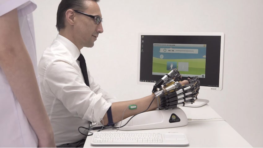 Así funciona la mano robótica. 