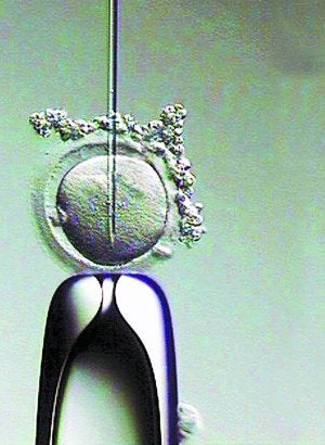 En aumento. El retraso en la edad de la maternidad obliga a cada vez más parejas a recurrir a técnicas de reproducción asistida para poder tener un hijo. ::
EFE