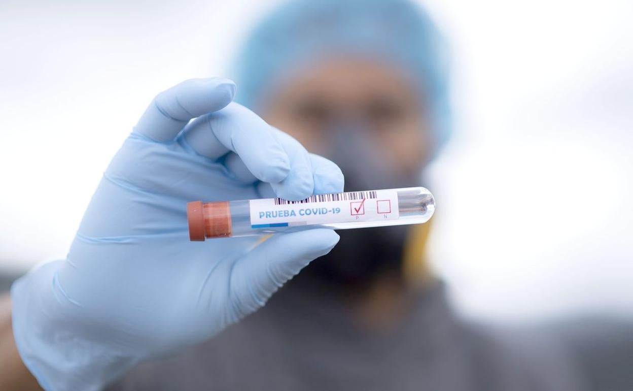 Imagen de una muestra de sangre para análisis covid.