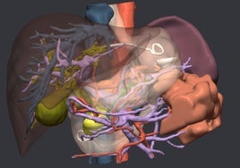 Modelo anatómico en 3D.