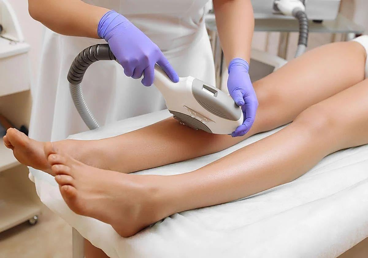 Depilación láser.