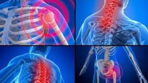 Jornada sobre la fibromialgia