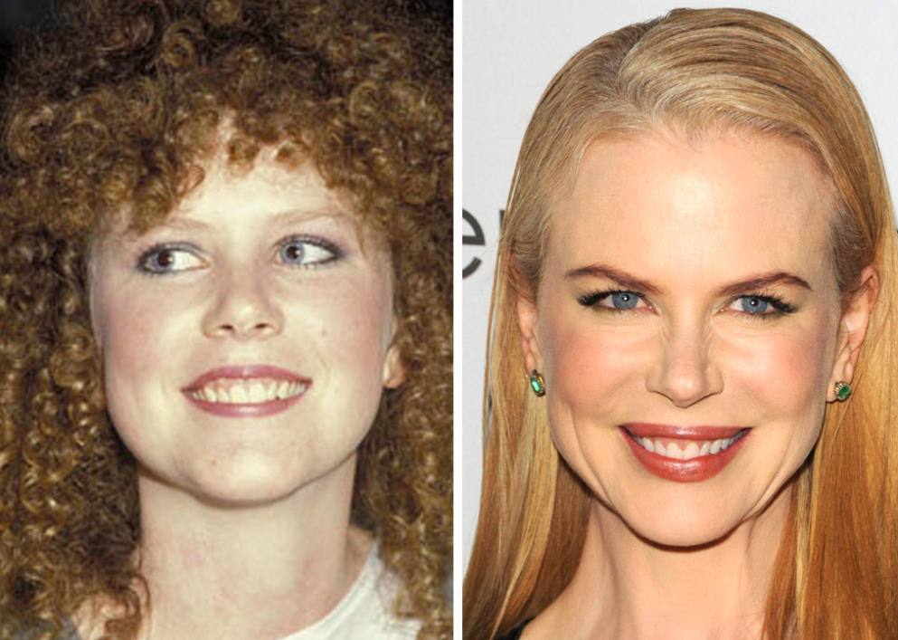 Nicole Kidman