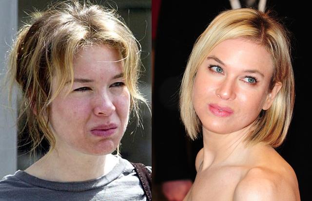 Renee Zellweger. 