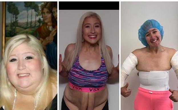 La contundente respuesta de una joven que perdió 158 kilos y todavía se burlan por su físico