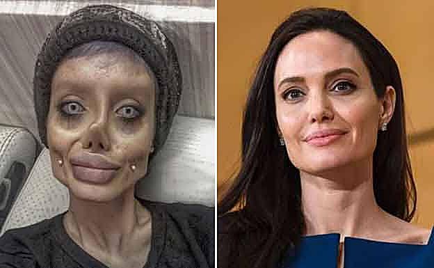 Se somete a 50 operaciones para parecerse a Angelina Jolie y este es el resultado