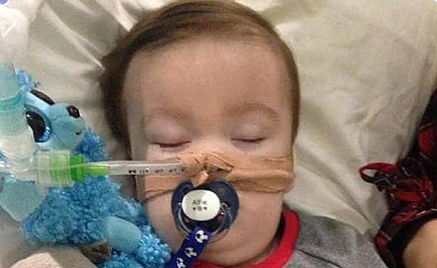 El bebé Alfie Evans respira por sus propios medios desde que fue desenchufado