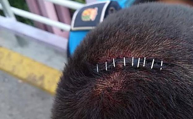 Uno de los agentes heridos en Getafe muestra una de las heridas que le produjeron en la cabeza 