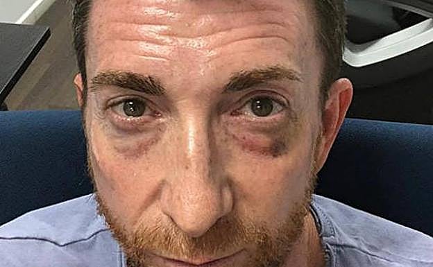 La alarmante imagen de Pablo Motos