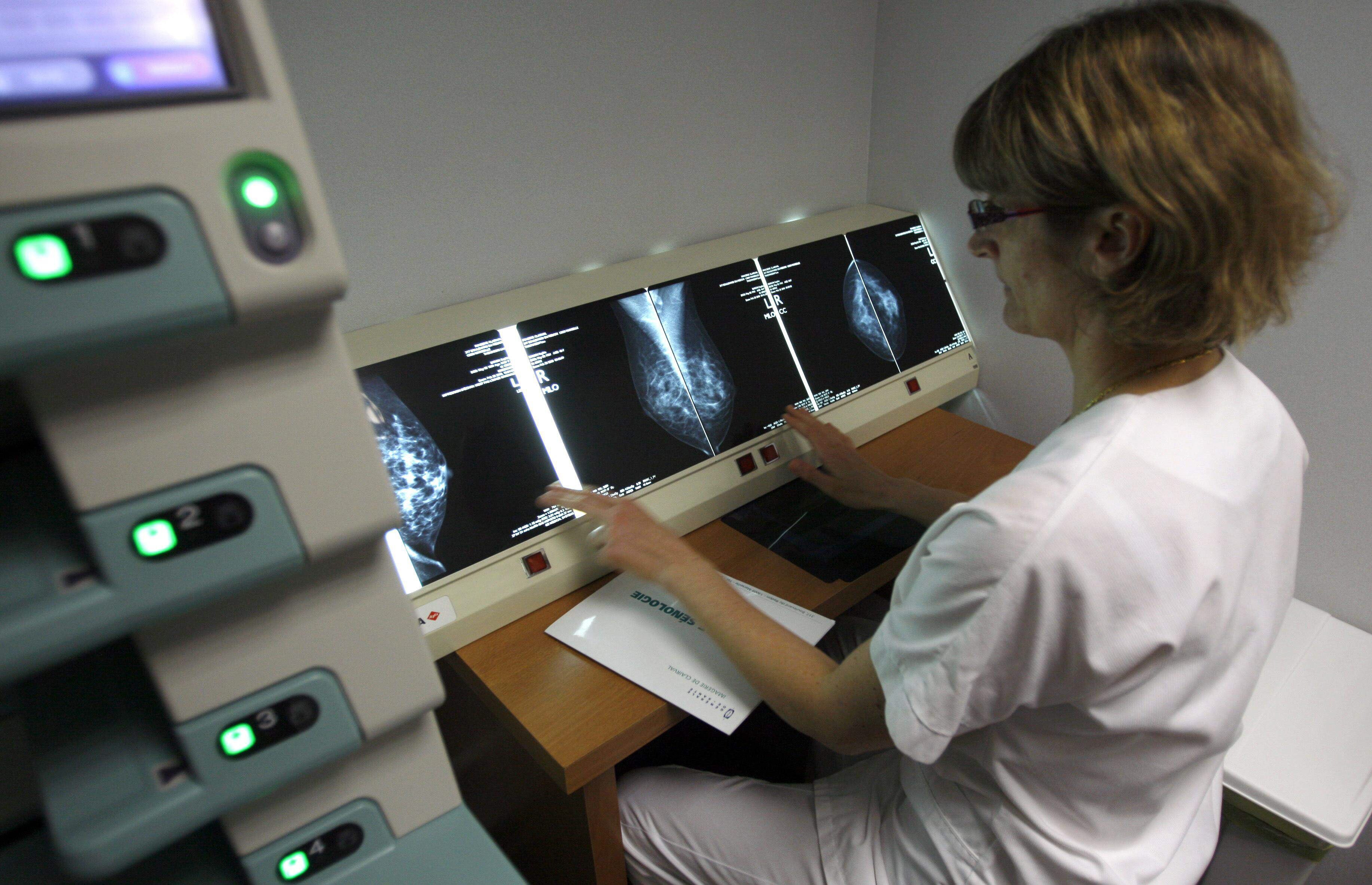 Personal sanitario observa una mamografía.