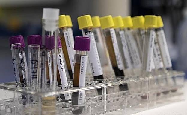 Un simple análisis de sangre predice el daño de alzhéimer 16 años antes de los primeros síntomas