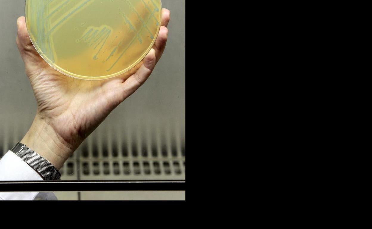 Un cultivo de listeria, en el Laboratorio del HUCA. 