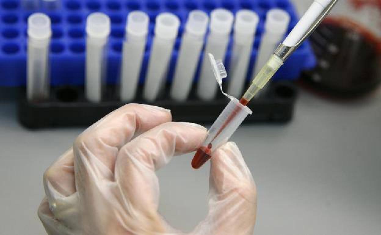 Asturias detectó 54 nuevos casos de VIH en 2018