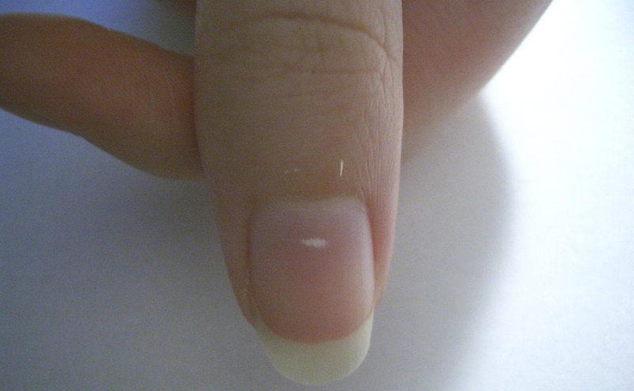 Las bacterias distorsión Informar Qué son las manchas blancas que salen en las uñas? | El Comercio: Diario de  Asturias