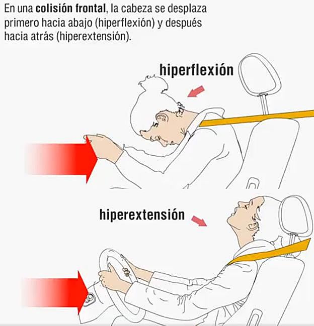 Consecuencias de un choque frontal.