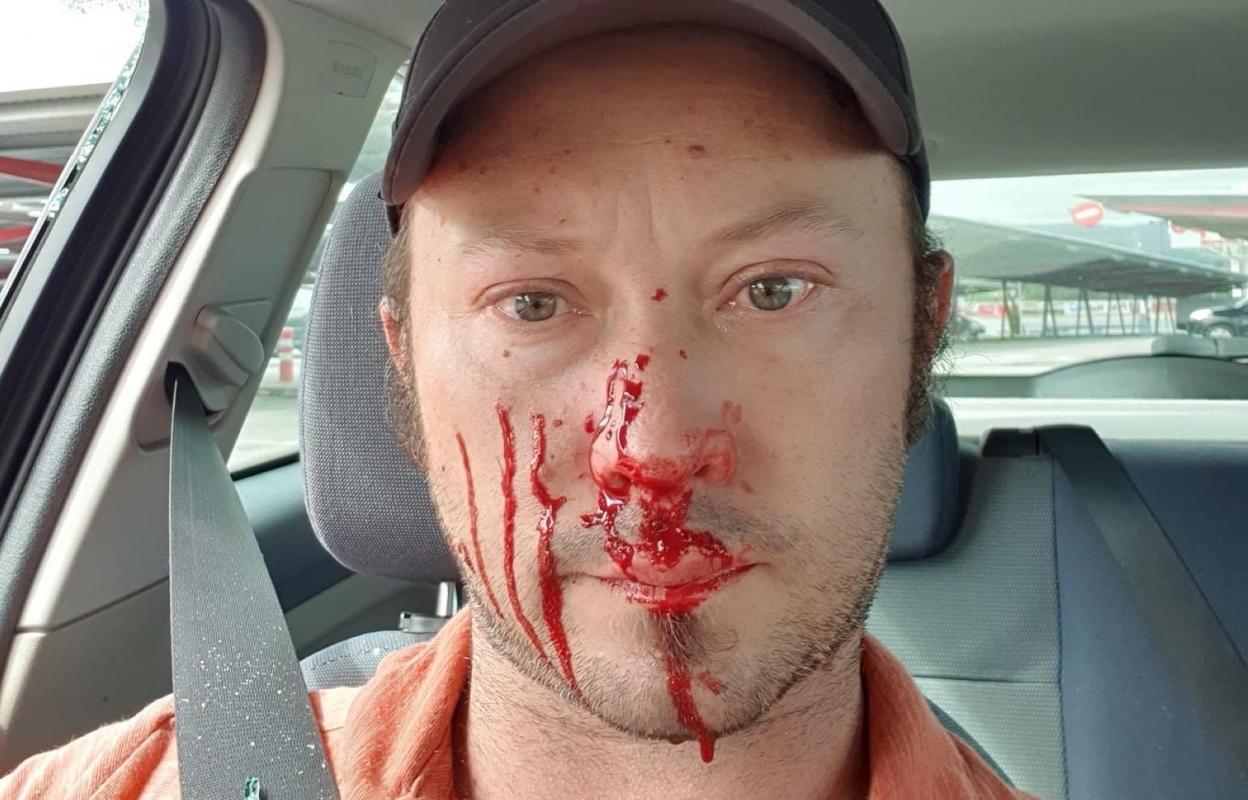 Andrew Wadsworth tras el incidente. 