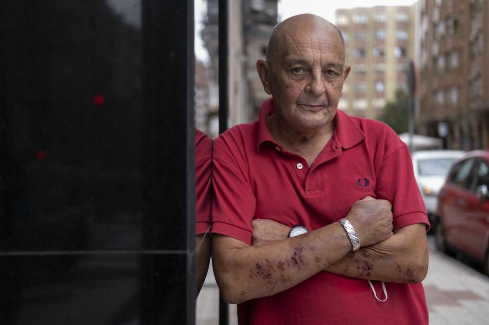 José Ángel Bango, ayer, en la calle San José, tras relatar para EL COMERCIO cómo ocurrió el accidente. 