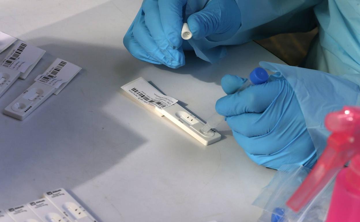 Test de antígenos. 