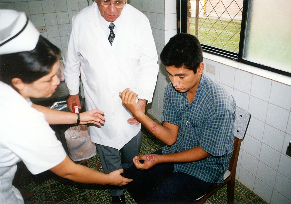 Un enfermo muestra las llagas provocadas por una enfermedad.