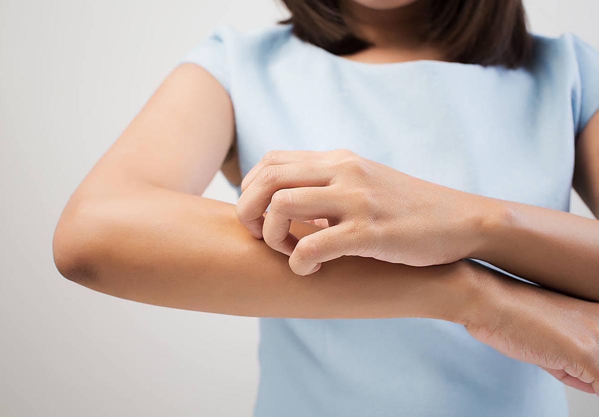 Alerta por una plaga de mosca negra en España: cómo actúa y qué hacer