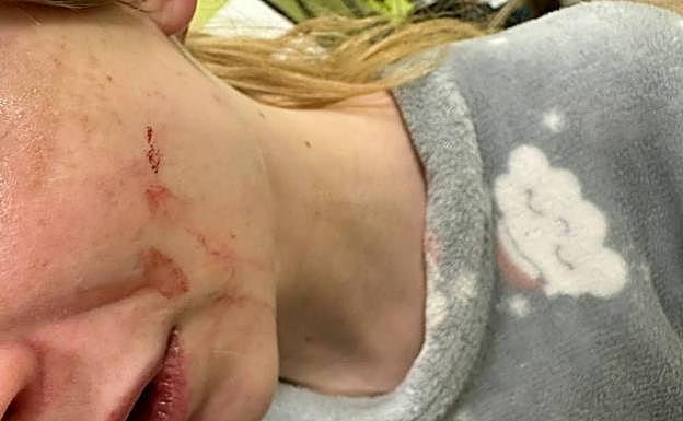 La joven agredida, en el centro de salud.