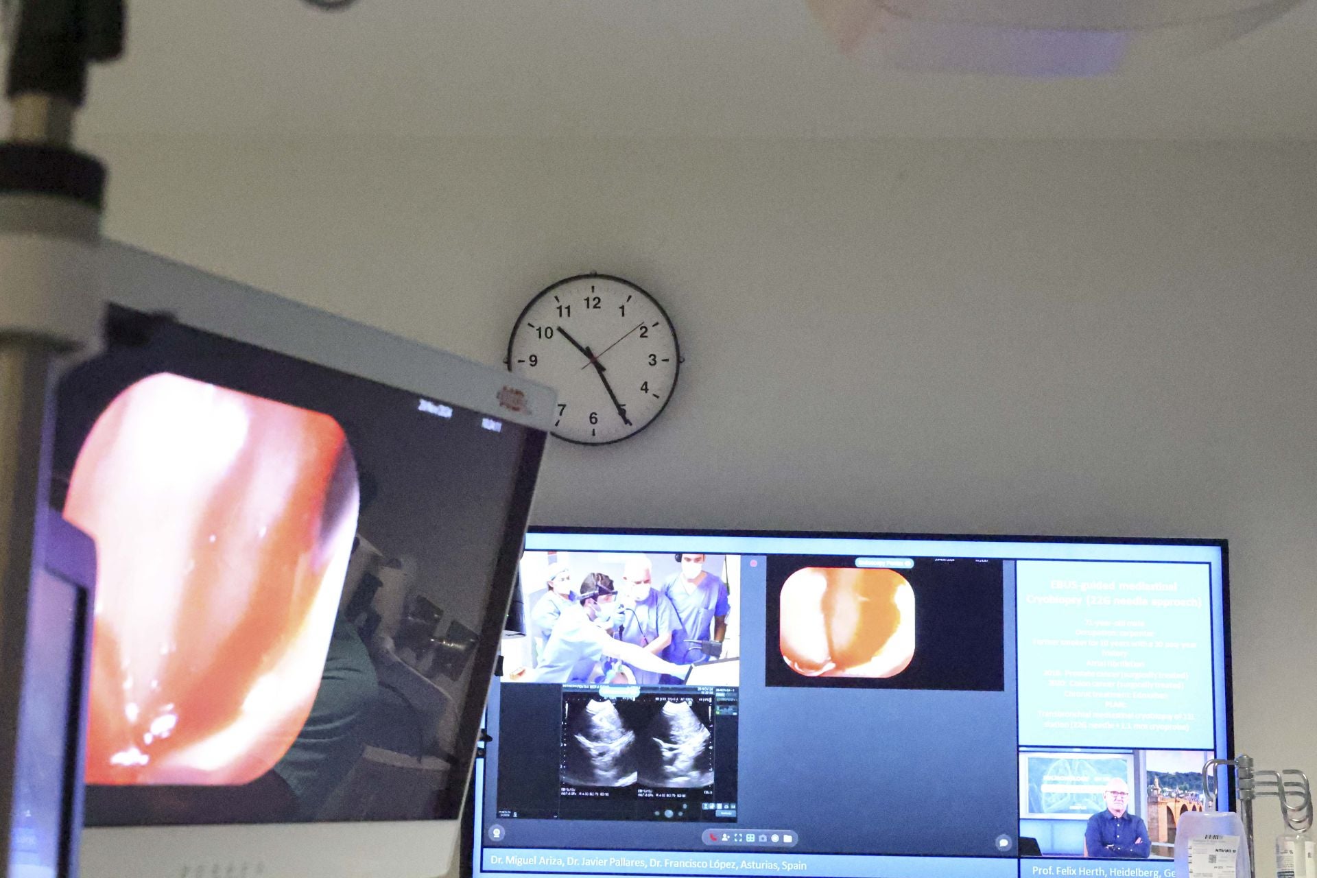 Una nueva técnica de biopsias por congelación de Asturias al mundo: las imágenes de la operación en el HUCA