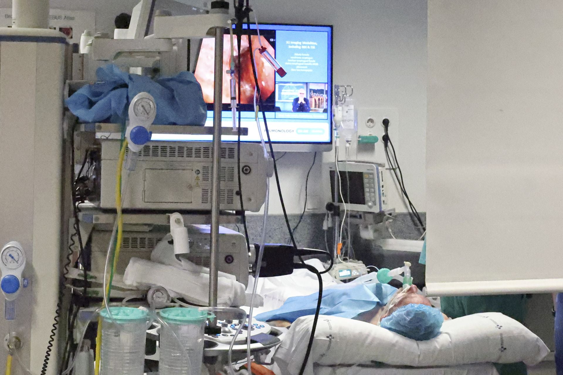 Una nueva técnica de biopsias por congelación de Asturias al mundo: las imágenes de la operación en el HUCA