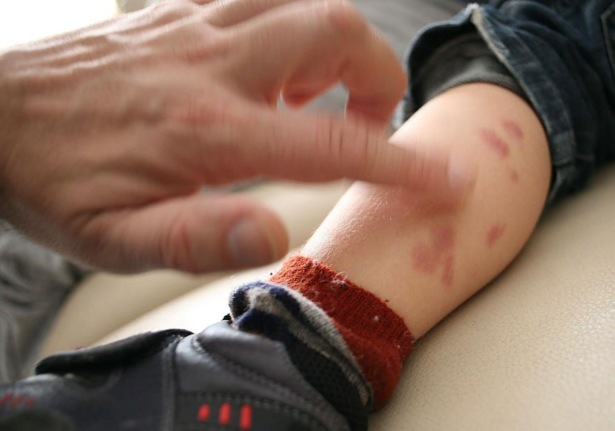 Un menor con lesiones en la piel siendo evaluado por un especialista