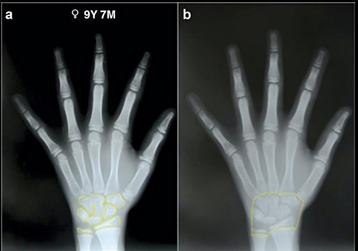 Imagen principal - Radiografías de unas manos y una dentadura.