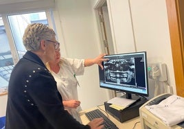 Alicia Rodríguez y Concepción Saavedra observando una ortopantomógrafía