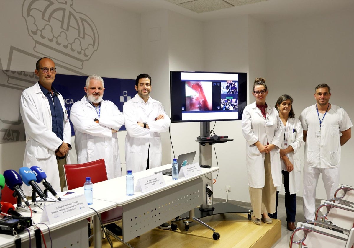 El HUCA aplica una técnica pionera en Europa que permite destruir mediante microondas los tumores endobronquiales