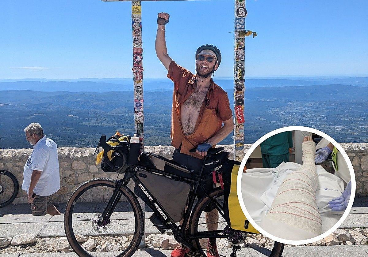 Harry Elliott, el montañero que sufrió un accidente en Picos de Europa; abajo a la derecha, una imagen del estado de su pierna.