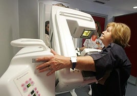 Una mujer se realiza una mamografía en el Hospital de Cruz Roja, que colabora con el Sespa en el programa de cribado de cáncer de mama.