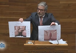 Jové, durante su intervención en el último Pleno, mostrando las ilustraciones de los genitales.