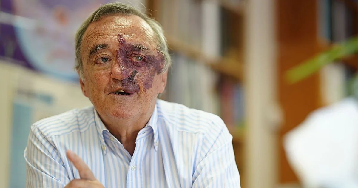 Mariano Barbacid Pancreas : ce qu'il faut savoir — image 1