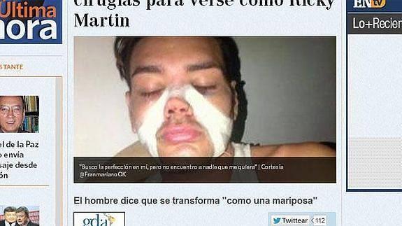 Se opera para parecerse a Ricky Martin porque no liga