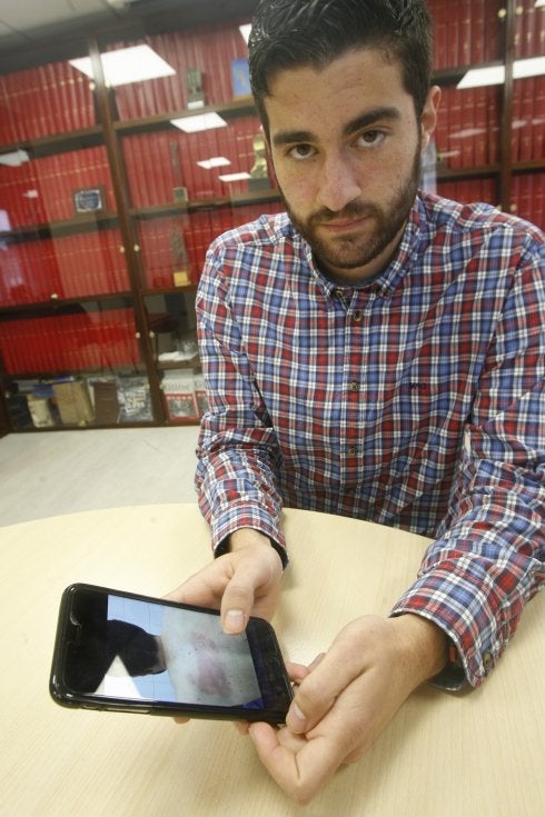 Daniel Almeida, con su teléfono, en el que se puede observar cómo le quedó la espalda tras la agresión. 