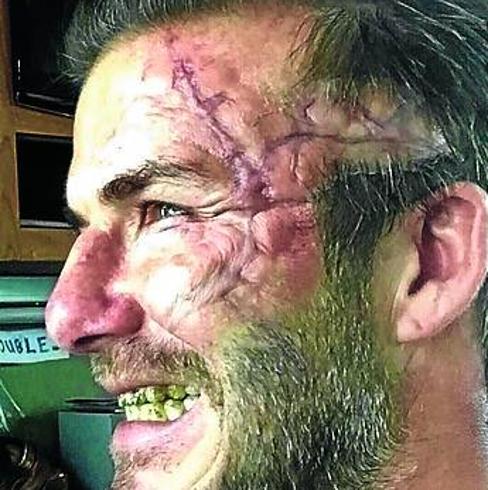 Las espeluznantes cicatrices de cine de David Beckham