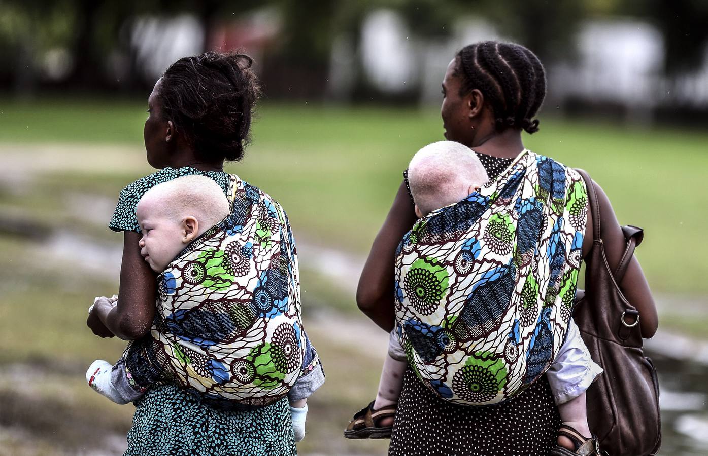 El drama de los albinos de Tanzania