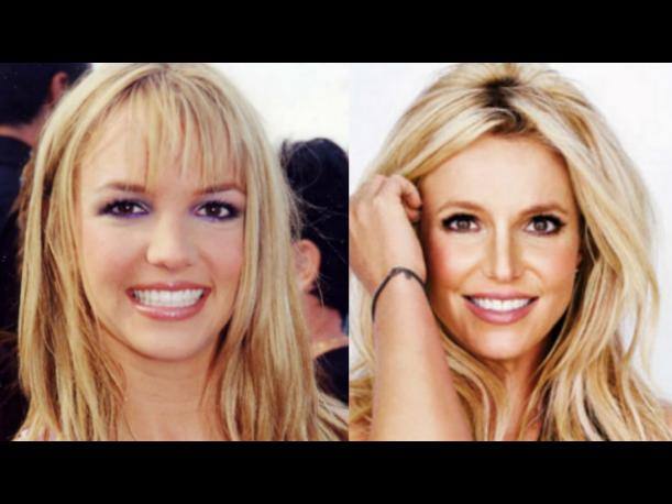 Britney Spears, antes y después de operarse. 