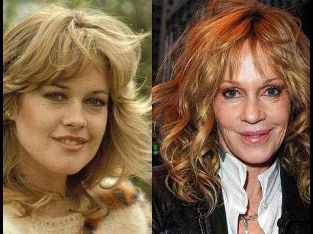 Melanie Griffith, antes y después de operarse.. 