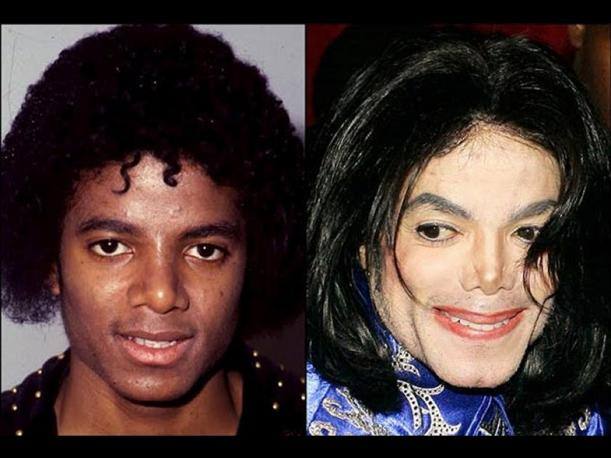 Michael Jackson, antes y después de operarse. 