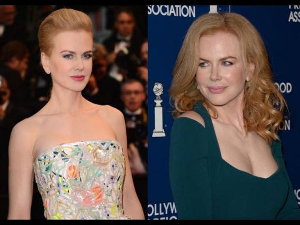 Nicole Kidman, antes y después de operarse.. 